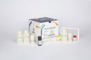 Echinococcus IgG / pishtaz teb / پیشتاز طب / کیت تشخیص طبی 